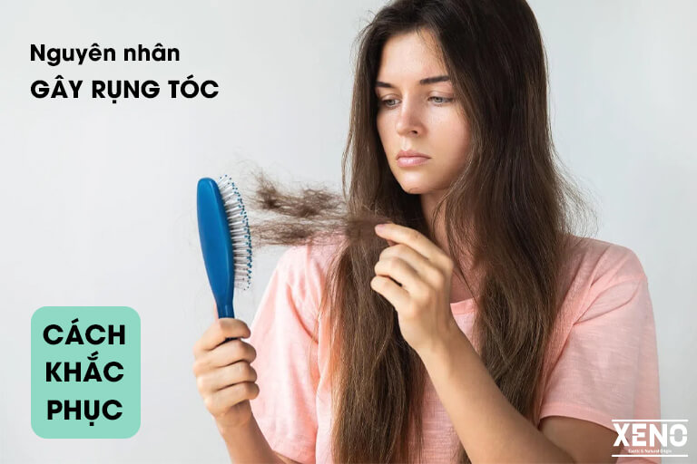 nguyen-nhan-gay-rung-toc